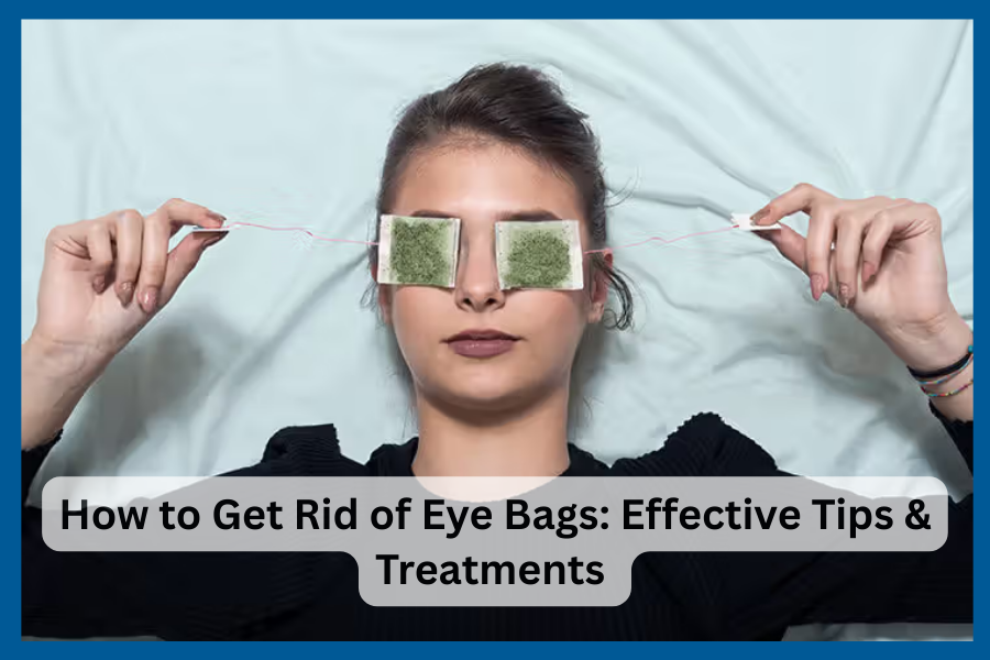 How to Get Rid of Eye Bags Fast: Natural & Effective Remedies